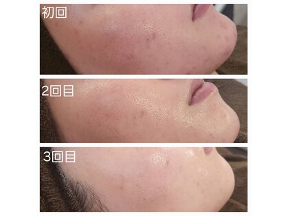 チル アウト(CHILL OUT)の写真