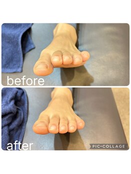 ポドウオーク(PODO WALK)/浮指