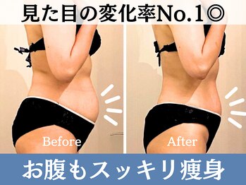 サンティエールの写真/【疲れや脂肪分解も◎全身リフトアップ】バストもウエストも整える骨盤エステでリバウンドのお悩みも解消！