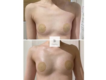 ミセルビューティー 御堂筋本町(micell beauty)の写真/女性らしさをひきだす脂肪増殖