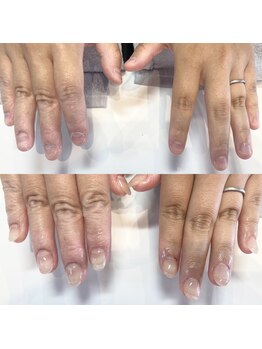 アイネイルズ 布施店(I.NAILS)/深爪/深爪矯正/自爪風ネイル