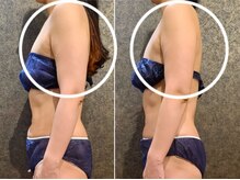 ワンルーム(1ROOM)/左Before 右After写真