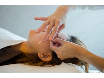 デルタエヌピー63+(δnp63+)/お客様施術例【小顔/薬院/福岡】