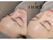 ヴィヴィエル 天王寺店(viviell)/フェイスワックス脱毛