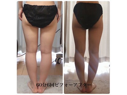 ベルフィーヌ 北千住店(BELFINE)の写真