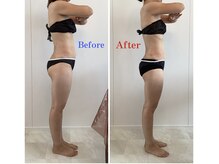 サロン ド メタセコイア(salon de Metasequoia)/30代女性