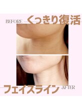 マナ(mana)/くっきりフェイスライン復活！！