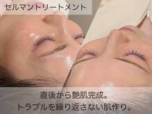 クレスト(CLEST.)/直後からこの仕上がり