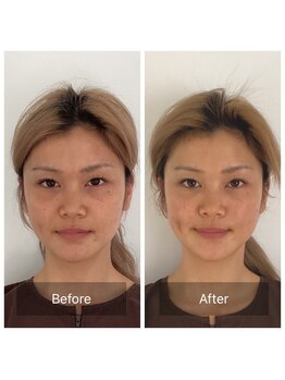 ハリオン 中目黒(HARI-ON)/ビフォーアフター