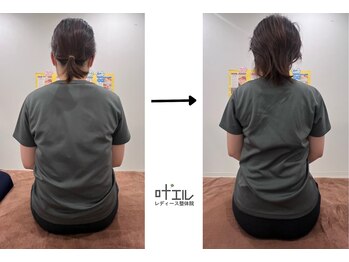 叶'エル 本町 心斎橋院/姿勢改善　骨盤矯正