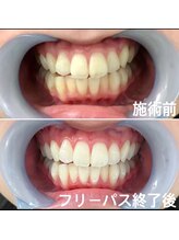 ルブラン 奈良店(Le Blanc)/8020運動！！！！