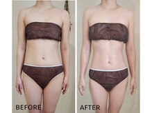 ラプタス(Rapu+)の雰囲気(寸胴体型、幼児体型にも効果的!腹筋を鍛えて引き締まったくびれ)