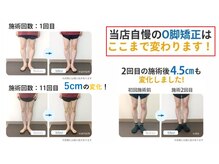むね整体院 カナザワ(KANAZAWA)の雰囲気(当店自慢のO脚矯正はここまで変わります!)