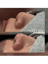 ナチュリー(Natully)/お客様ビフォーアフター