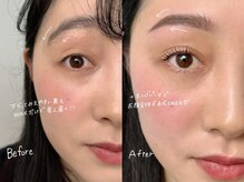 リブレ(Libre)/セットメニューで垢抜け目元