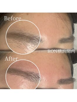 サロンロン 横浜関内(SALON RON)/眉毛は美容電気脱毛で綺麗に♪