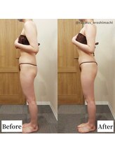 レイプラス 仙台店(RAY PLUS)/◆ビフォーアフター例のご紹介◆