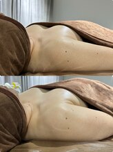 エレガンスアンドビューティー 船橋本店(Elegance&Beauty)/一回で結果がわかります！