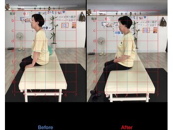 ストレチックス 近江八幡店/before/after