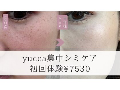 ユッカ(yucca)の写真