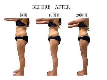 ヨサパーク サノン(YOSA PARK Sanon)/2か月コースの効果