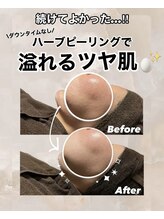 ビレボ マエバシ(BEREVO maebashi)/Before　After