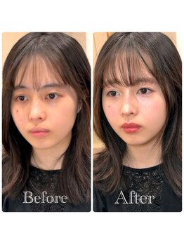 シャルム(Sharme)/お客様Before→After