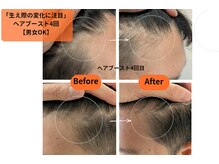 アリー(Alii)/ヘアブースト.ハーブ導入4/6回目