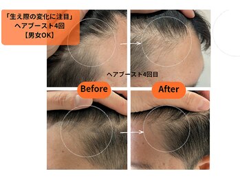 アリー(Alii)/ヘアブースト.ハーブ導入4/6回目