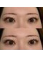 バニーアイズ 天神(Bunny eyes TENJIN)/フラット付け放題