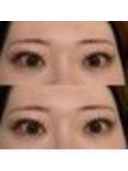 バニーアイズ 天神(Bunny eyes TENJIN)/フラット付け放題