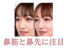 隆鼻矯正専門店 ラプリ(Raplit)の雰囲気(鼻筋と鼻先に注目☆中目黒/小顔/小顔矯正)