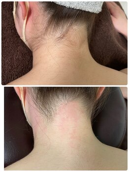 エン(en.)/BeforeAfter写真43