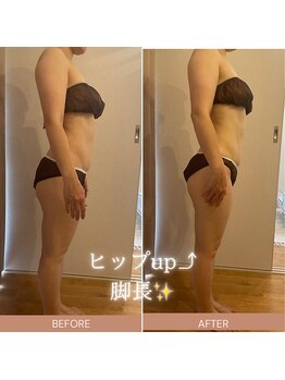 エイミー 藤ヶ丘店(Amy)/before→after