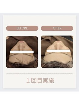 美々庵/光フェイシャル◆