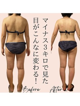 サロン ド ボーテ ラーンジュ 岐阜店(salon de beaut'e L'ange)/ハイパ-ナイフEX2ダイエット痩身