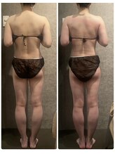 エレラビューティー(ELERA beauty)/お客様before after筋膜リリース