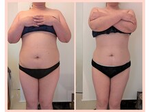 ワイズ(Y's)/お腹16回目