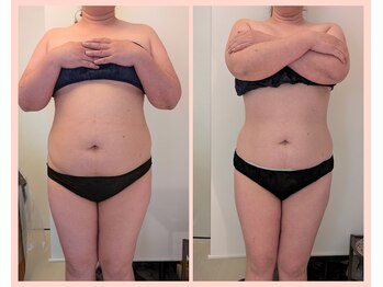 ワイズ(Y's)/お腹16回目