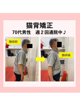ほねつぎ長嶺鍼灸接骨院/ビフォーアフター2