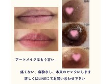 ユウビビューティサロン 東生駒(Yuubi Beauty Salon)の雰囲気（ローマピンク導入メラニンを除去します。3-5年は持続。）
