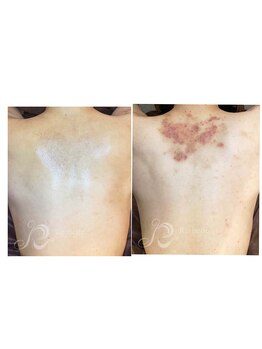 マヴィー(MAVIE)/リベルハーブピーリング