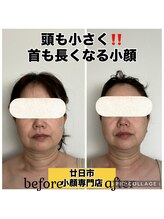 ルース(LUCE)/コルギ＋チノザメソッド