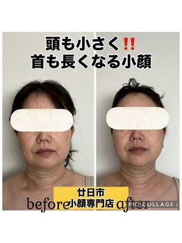 ルース(LUCE)/コルギ＋チノザメソッド