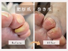 菊桃(kikumomo)の雰囲気（カットしにくい分厚く食い込んだ爪！痛みなくスッキリ美しく♪）