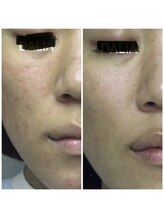 ダリア(DALIA)/敏感・乾燥肌