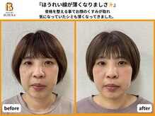 ブプラ 香椎店(BUPURA)/before→after