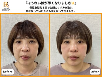 ブプラ 香椎店(BUPURA)/before→after