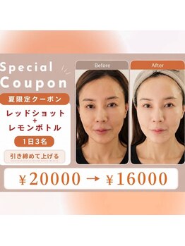 アン 銀座(ann)/夏限定クーポン