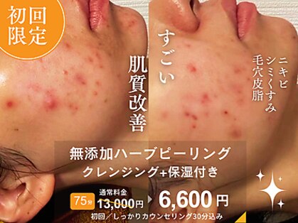 ハリサロンドオフ 心斎橋店(hari salon de off)の写真